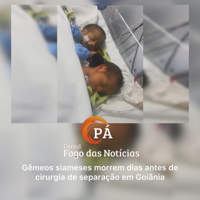 PÁ portal das Notícias | Bernardo e Eduardo não resistem a infecção grave e morrem em hospital de Goiânia